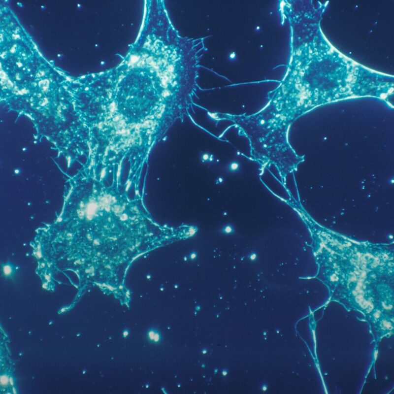 a close up of a cell phone with a blue background