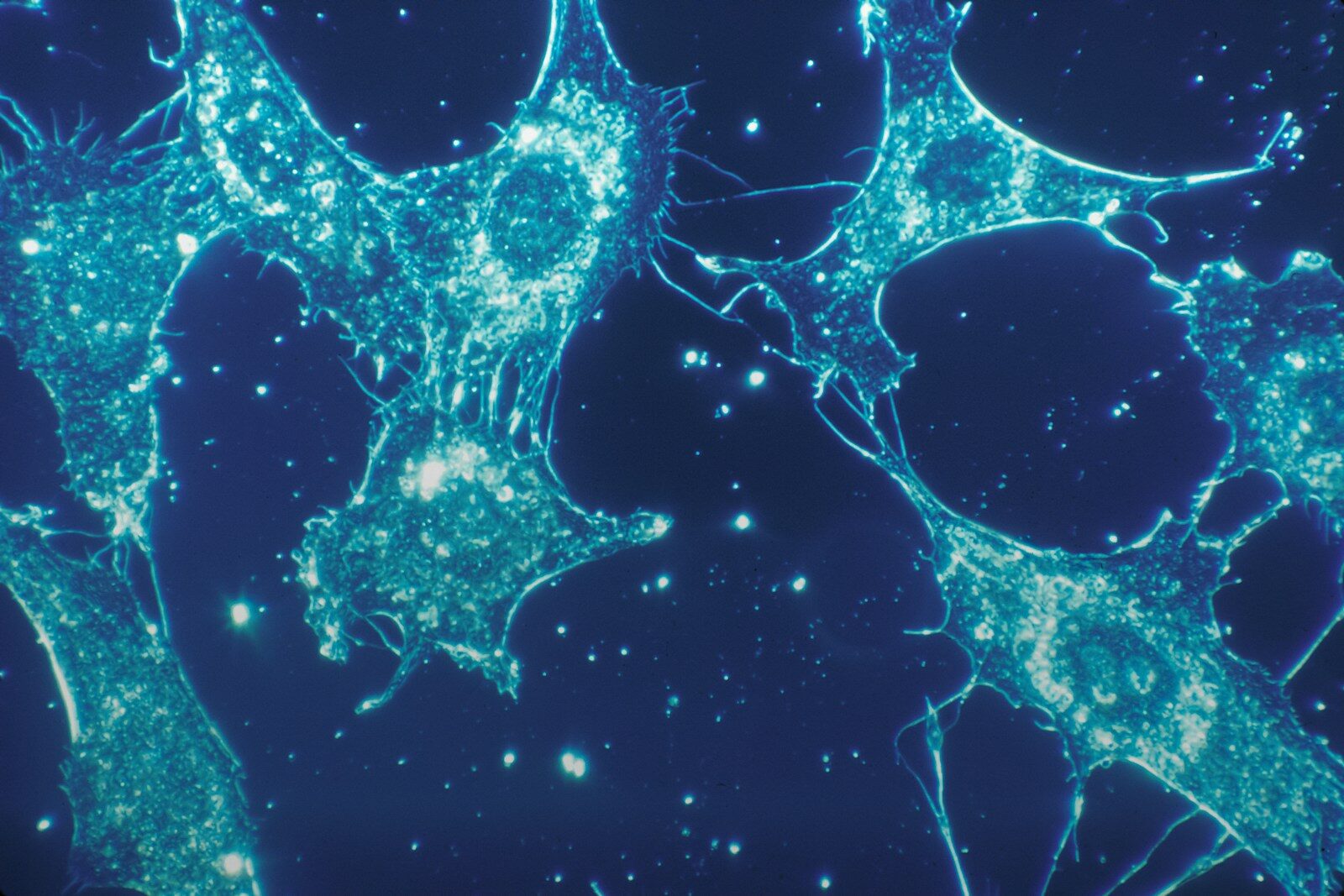 Cellules souches : risques génotoxiques et contrôles de qualité dans le développement de la thérapie cellulaire